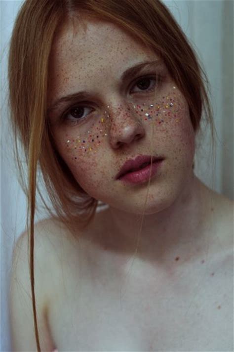 Freckle Faced Beauty Or Not
