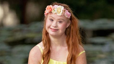 Redhead Model With Down Syndrome Madeline Stuart