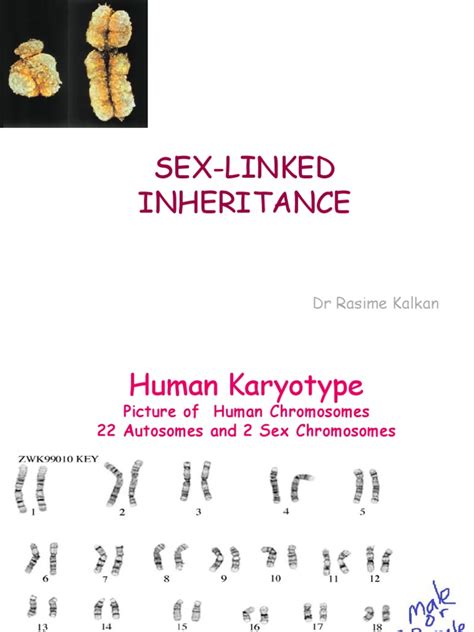 Sex Linked Inheritance 6 Pdf Pdf Genetic Disorder Dominance