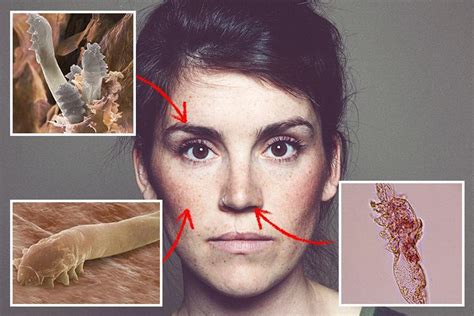 these are the horrifying creepy crawlies living on your face and you