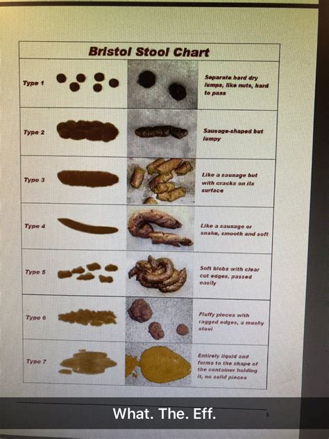 fantastically accurate bristol stool chart rnursing