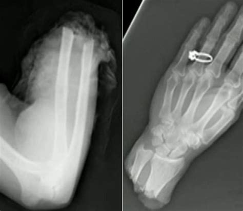 amazing x rays photos yikes craziest x rays