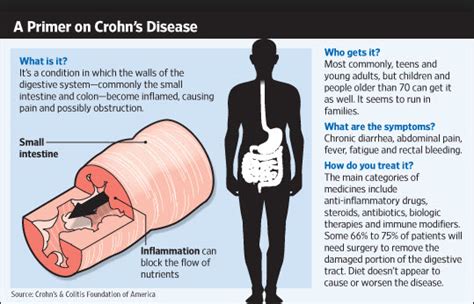 crohn s disease symptoms causes and treatments