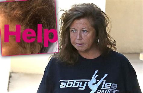 Abby Lee Miller Hair Falling Out Photos Cancer Treatment Dance Moms