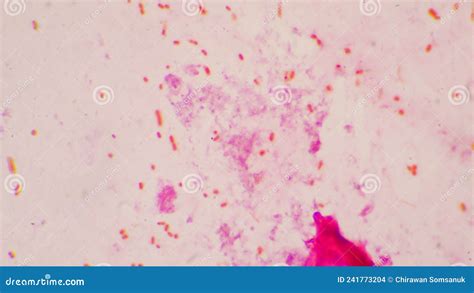 Bacteria Cell Gram Neagative Bacilli With Capsule Pathogen Sample