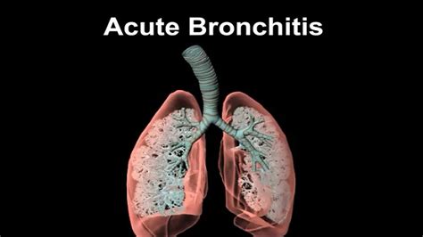 acute bronchitis video dailymotion