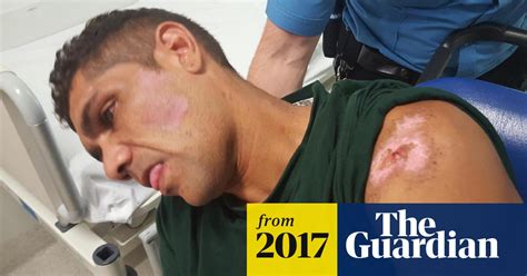 Indigenous Man Filmed With Whole Body Tremors Days After Being Tasered