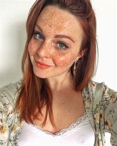 Pin By Brazil Fans On Sardas Red Haired Beauty Red Hair Freckles