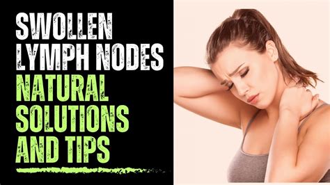 How To Treat Swollen Lymph Nodes Naturally Remedies Solutions And Tips