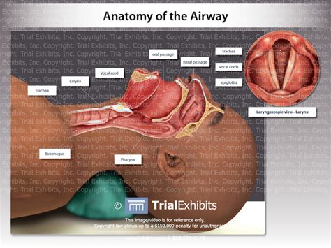 Anatomy Of The Airway Trialexhibits Inc