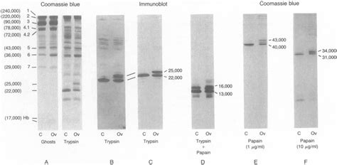 molecular defect of the band 3 protein in southeast asian