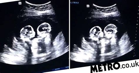 twin babies filmed fighting   womb metro news