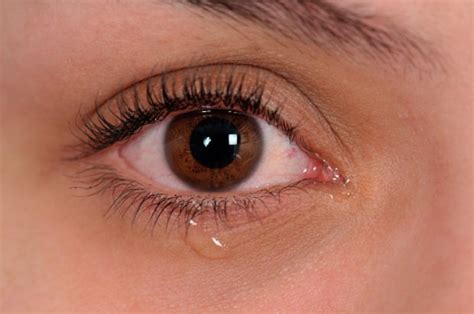 Common Causes Of Burning Eyes Symptoms And Treatment Tips