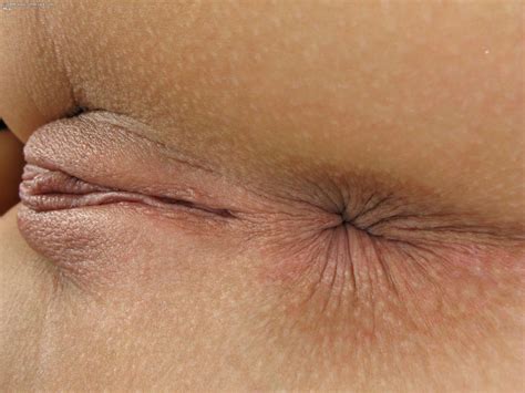 really swollen vagina