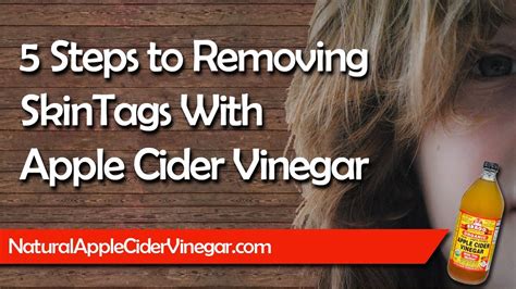 using apple cider vinegar to remove skin tags in 5 simple steps youtube