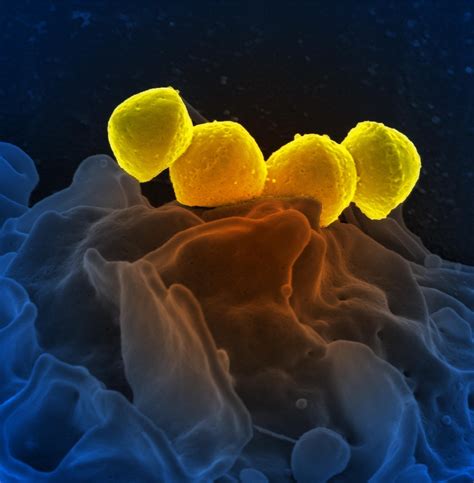 Types Of Group A Streptococcal Infections Nih National Institute Of