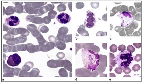 morphological analysis of exposed and sham leukocytes to emr in panel