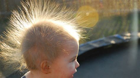 uncombable hair syndrome   rare genetic syndrome