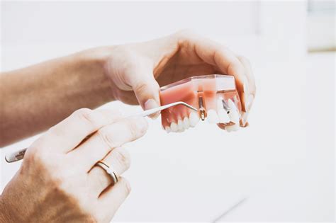orthodontie de website van tandartsen