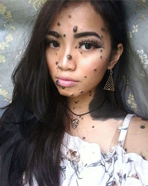 woman born with moles all over her body defies beauty standards