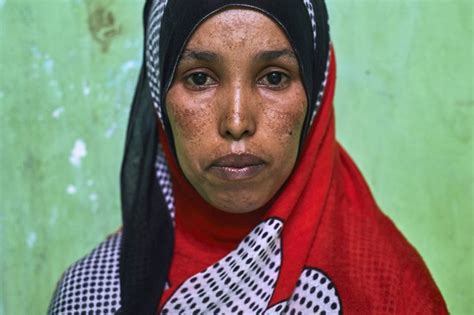 The Heartbreaking Life Of Somali Refugee Women In Indonesia In Pictures