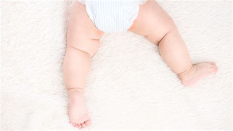 penyebab   mengatasi ruam  kulit bayi
