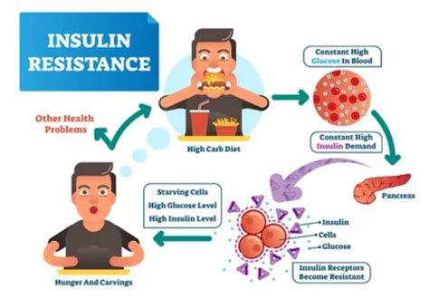 type  diabetes   reverse type  diabetes explained