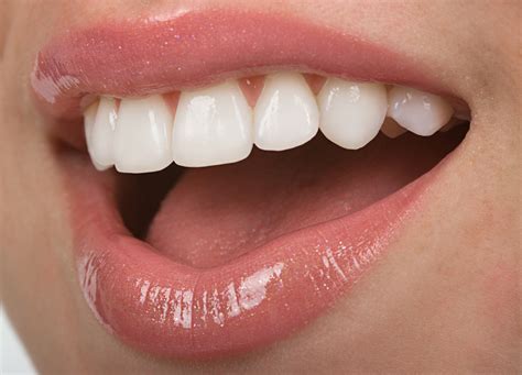 cosmetic bonding vs porcelain veneers which option is right for me