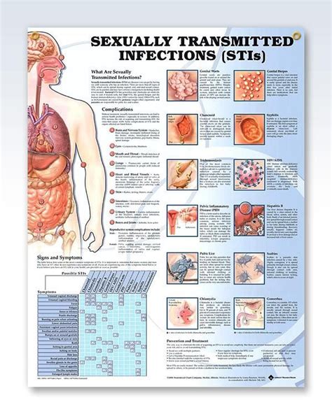 Sexually Transmitted Infections Poster With 2 Grommets Medical