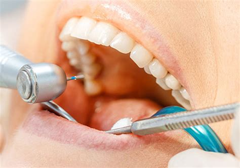 dental emergency  garland proactive oral health garland dr vidya