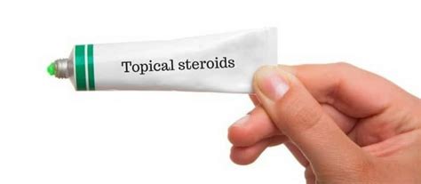 cortisone steroid creams skin naturopath holistic