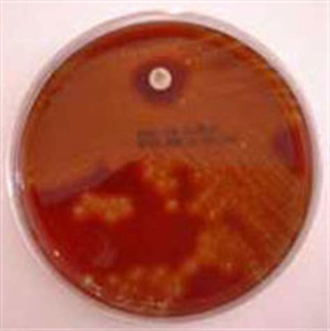 clinical micro stat rapid strep