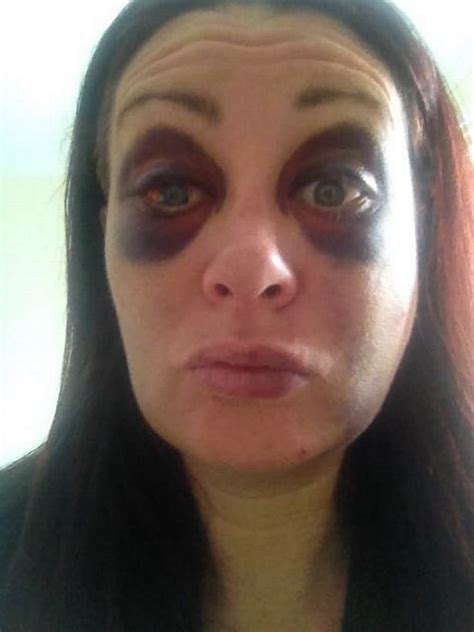 Daily Selfies Show Woman S Abuse At The Hands Of Her Ex