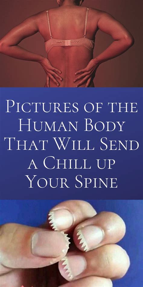 pictures of the human body that will send a chill up your spine funny