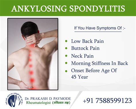 ankylosing spondylitis    treatments
