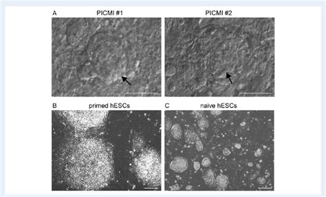 Different States Of Pluripotency In Hescs A Plating