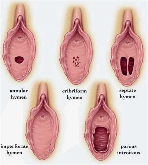 hymens before and after cumception