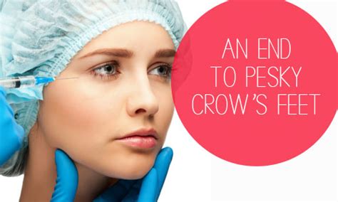 How Botox Is Being Used As A Temporary Alternative To Facial Surgery In