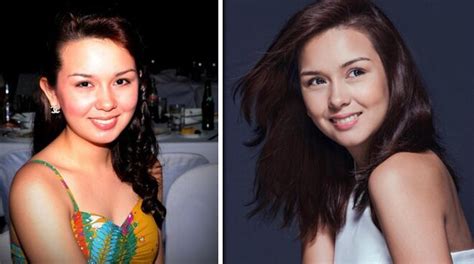 Xander Is Not Alone Pinoy Celebs Who Admit Undergoing Plastic Surgery