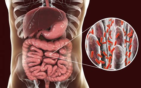 bacterias intestinales ayudan  combatir el cancer sistema mexiquense de medios publicos