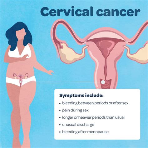 what is gynaecological cancer and what are the symptoms queensland health