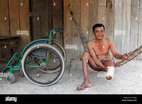 crippled man  res stock photography  images alamy