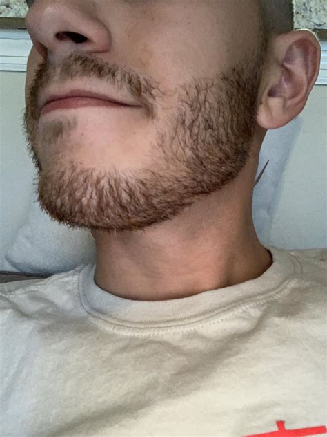 patchy beard   fill rbeards