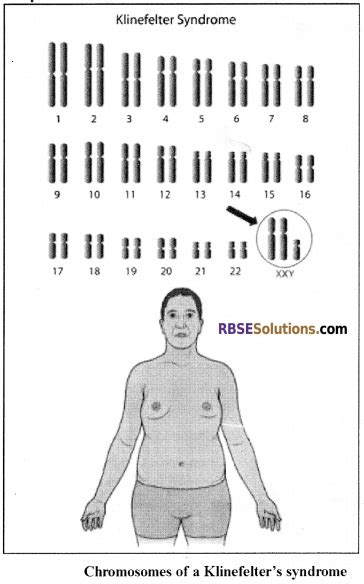 Rbse Solutions For Class 12 Biology Chapter 36 Man Chromosomal