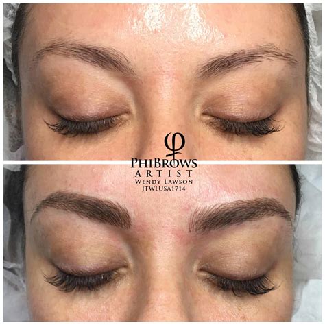 microblading and microshading alite laser hair removal