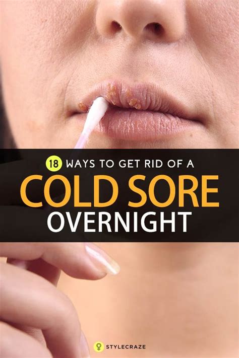 how to get rid of cold sores 19 ways healing cold sore get rid of cold blister remedies