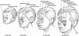 Sinus Anatomy Ages Craniofacial Otolaryngology sketch template