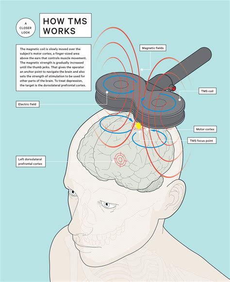 buzz  brain stimulation transcranial magnetic stimulation