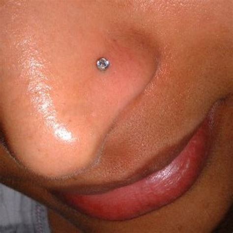 cartilage piercing infection picture mindtpkitru