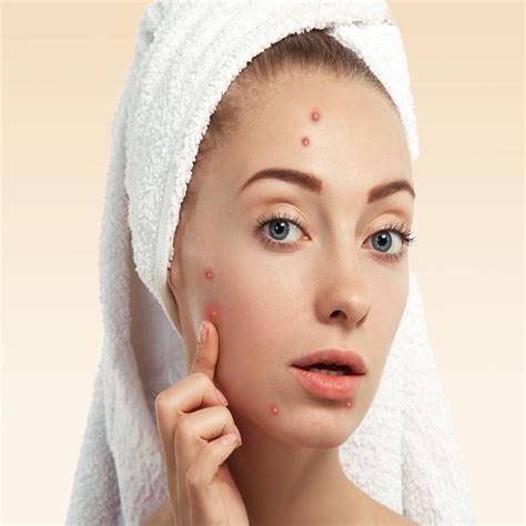 acne treatment kamals day spa